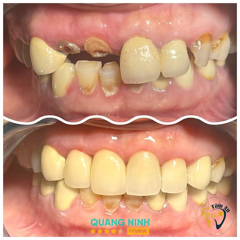 Nha Khoa Quốc Tế Tâm An – hình ảnh 3
