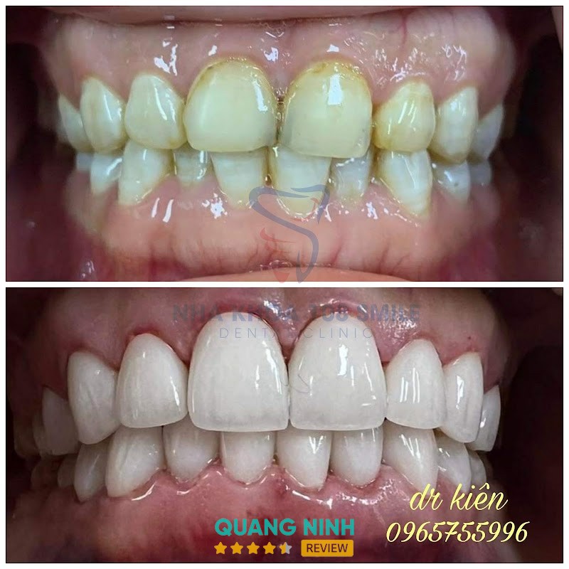 Nha Khoa 108 Smile - hình ảnh 2