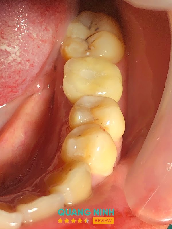 Nha Khoa 108 Smile – hình ảnh 3