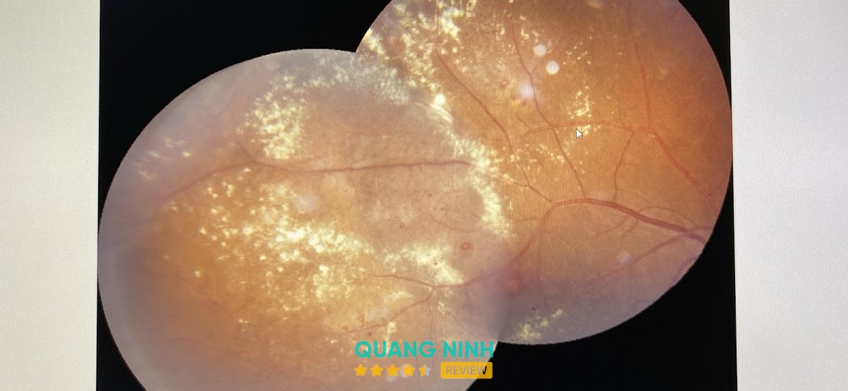 Phòng khám mắt - Bs Tuyến – hình ảnh 3
